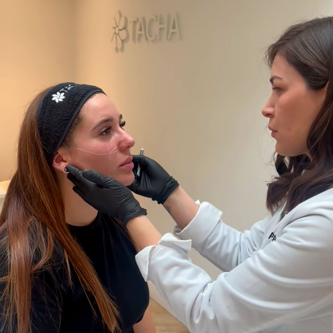 Almaformer glow - Imagen 4