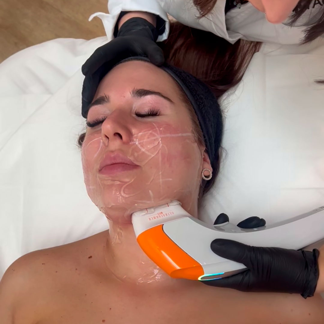 Almaformer glow - Imagen 3